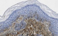 Anti-Glycosaminoglycan Antibody, skin specific Antibody, clone PG-4 