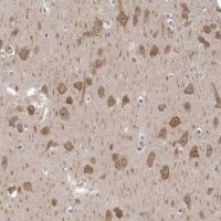 Anti-GSK3B antibody produced in rabbit 