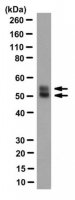 Anti-Herpes Simplex Virus Glycoprotein D Antibody, clone LP14 