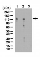 Anti-HIF-1-alpha Antibody, hydroxyproline (Pro402) 