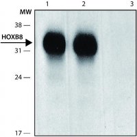 Anti-HOXB8 (N-terminal) antibody produced in rabbit 
