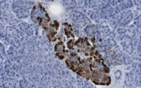 Anti-HPa2 Antibody, clone DHIC2-2B4 