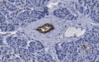 Anti-HPd2 Antibody, clone DHIC3-5H10 