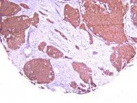 Anti-Hypoxia Inducible Factor 1 Antibody, clone H167 
