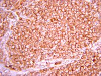 Anti-Hypoxia Inducible Factor 1 Antibody, clone H167 