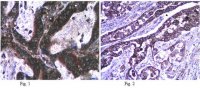 Anti-iNOS/NOS II Antibody, NT 