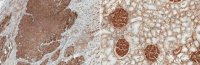 Anti-Integrin beta-1 Antibody, clone 102DF5 