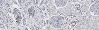Anti-IRP2 Antibody, clone 3B11 