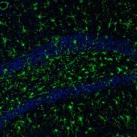 Anti-ITPKA antibody produced in rabbit 