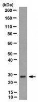 Anti-Kallikrein 7 (KLK7) Antibody, clone 83-1 