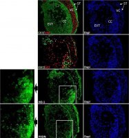 Anti-Ki-67 Antibody, clone Ki-S5 