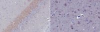 Anti-Kinesin Light Chain Antibody, clone 63-90 