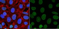 Anti-Lamin A/C Antibody, clone 2A1