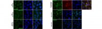 Anti-Lamin B Receptor (LBR) Antibody, clone BB2SS3F3 