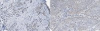 Anti-LATS1 Antibody, clone 9A3.1 