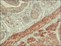 Anti-LMOD1 antibody produced in rabbit