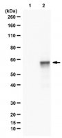Anti-Luciferase