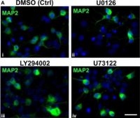 Anti-MAP2 Antibody, clone AP20 