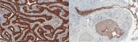 Anti-Mesothelin Antibody, clone MN-1 