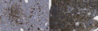 Anti-Microglobulin beta2 Antibody, clone BBM.1 