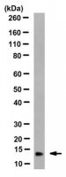 Anti-Microglobulin beta2 Antibody, clone BBM.1 