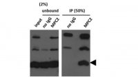 Anti-Mitochondrial Pyruvate Carrier 2 (BRP44) 