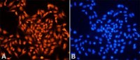 Anti-MSH6 (C-terminal) antibody produced in rabbit 