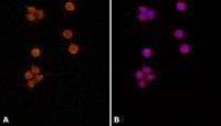 Anti-MSH6 (N-terminal) antibody produced in rabbit 