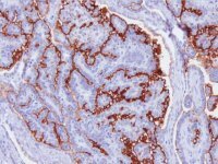 Anti-Mucin-16 (CA-125) Antibody, clone 5E11 MABC1608-25UG