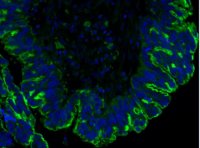 Anti-Mucin-16 (CA-125) Antibody, clone 5E11 MABC1608-25UG