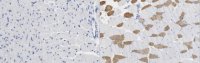 Anti-MYH-2 Antibody, clone 8F72C8 
