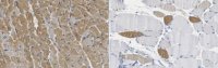 Anti-Myosin 7 (MYH7) Antibody, clone 4B51E8 