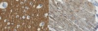 Anti-Na+/K+ ATPase alpha-3