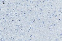 Anti-NeuN Antibody, clone 13E6, ZooMAb� Rabbit Monoclonal 