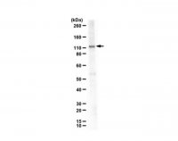 Anti-Neuropilin-2b 