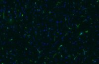 Anti-NG2 Chondroitin Sulfate Proteoglycan Antibody, clone 132.38 