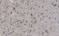 Anti-nonphospho-GSK3 (Ser9) Antibody, beta specific Antibody, clone 12B2 