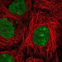 Anti-NSMCE2 antibody produced in rabbit 