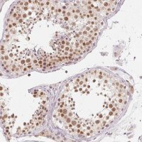 Anti-NXF3 antibody produced in rabbit 