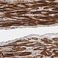 Anti-OSBPL9 antibody produced in rabbit 