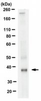 Anti-OSTM1 