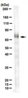 Anti-P40 (TP63) Antibody, clone 11H1 