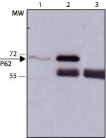 Anti-p62/SQSTM1 antibody produced in rabbit 