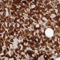Anti-PARP4 antibody produced in rabbit 