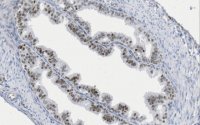Anti-Pax-8 Antibody, clone 15C8.1