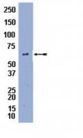 Anti-Perilipin A Antibody 