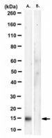 Anti-phospho-4E BP1 (Ser83) Antibody, clone CM14D3 