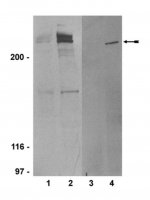 Anti-phospho-ATM (Ser1981) Antibody, clone 10H11.E12 