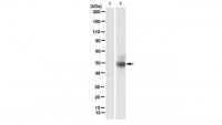 Anti-phospho-cytokeratin-18 (K18) (Ser33) Antibody, clone IB4 