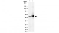 Anti-phospho-cytokeratin-8 (K8) (Ser431) Antibody, clone 5B3 